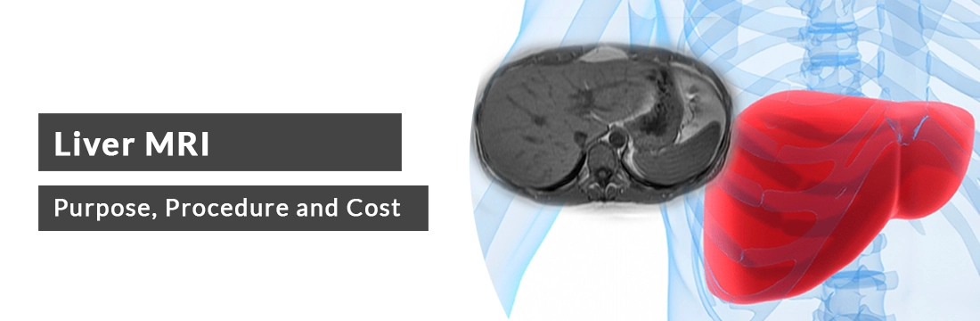 Liver MRI: Purpose, Procedure, Cost and Best MRI Centre